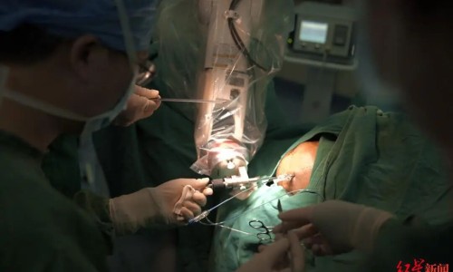 宫颈息肉手术真实感受-【宫颈息肉手术有几种方法】宫颈息肉手术治疗效果怎么样啊 - 宫颈息肉手术治疗效果怎么样网