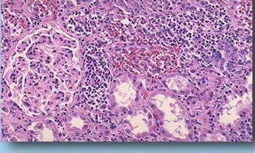 宫颈息肉手术费用和注意事项-【宫颈息肉手术有几种方法】宫颈息肉手术治疗效果怎么样啊 - 宫颈息肉手术治疗效果怎么样网